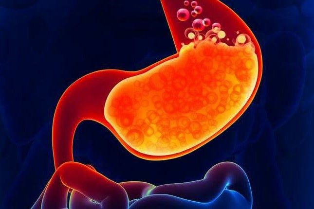 Kiat-Kiat Menjaga Tubuh bagi Penderita GERD Agar Tidak Kambuh 