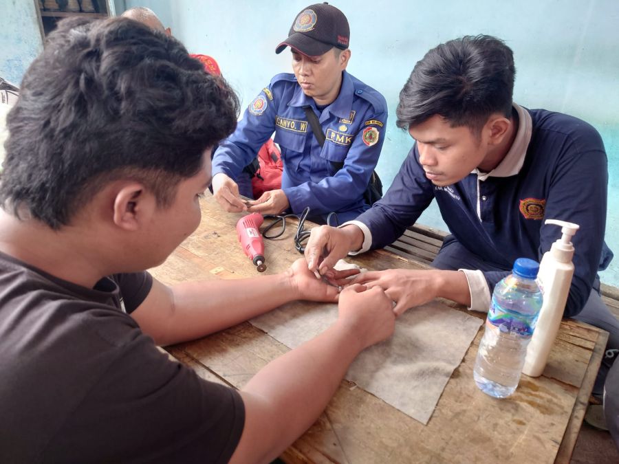 Tangan Bengkak, Pemuda Mojokerto Datangi Pos Damkar untuk Lepaskan Cincin Monel