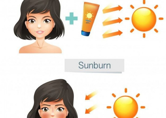 Pilih Sunscreen yang Tepat untuk Kecantikan dan Kesehatan Kulit Jangka Panjang