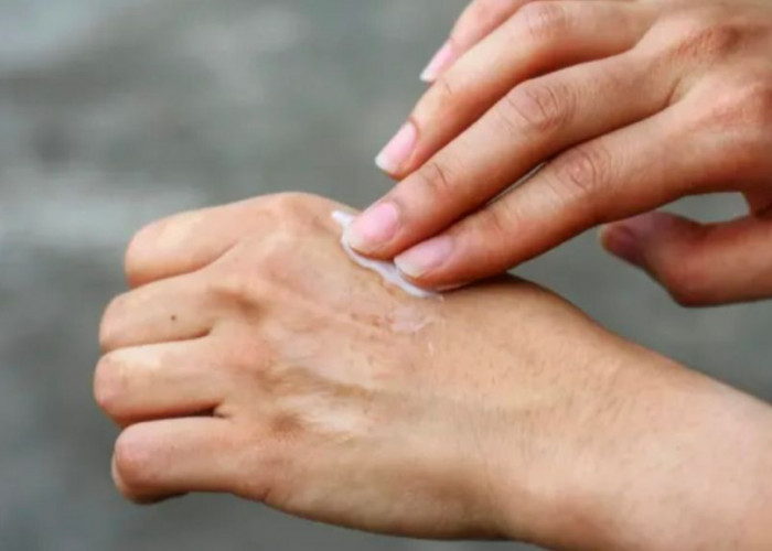 Body Care Viral Picu FOMO? Jangan Sampai Kejar Glow, Kulit Malah Bermasalah