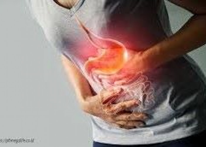 Tips Berbuka Puasa bagi Penderita Gerd dan Asam Lambung