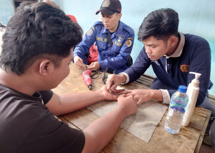 Tangan Bengkak, Pemuda Mojokerto Datangi Pos Damkar untuk Lepaskan Cincin Monel
