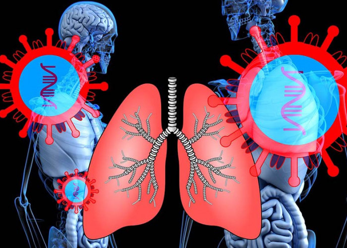 Apa Penyebab Kanker Paru-paru?