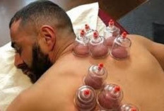 Ikhtiar Kesehatan Bekam Tak Sekadar Sunnah, Namun Punya Dampak Fisiologis bagi Tubuh