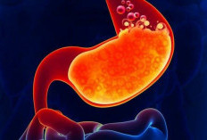 Kiat-Kiat Menjaga Tubuh bagi Penderita GERD Agar Tidak Kambuh 