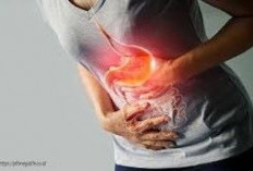 Tips Berbuka Puasa bagi Penderita Gerd dan Asam Lambung